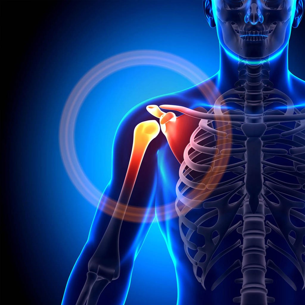 Épaulière de Compression Sportive – Soutien Léger pour Blessures et Prévention image 2