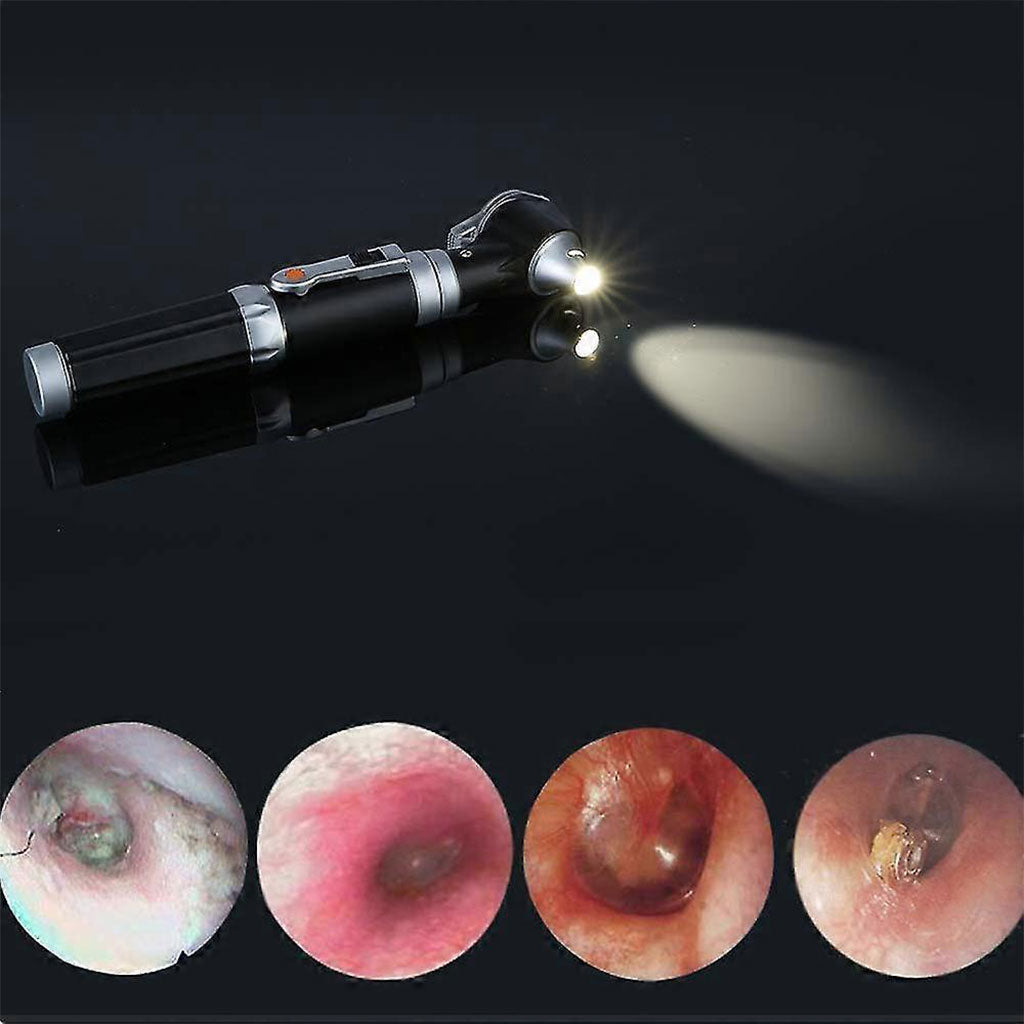 Otoscope Médical Staricare 3X LED Professionnel avec Éclairage Fibre Optique et Embouts Multiples
